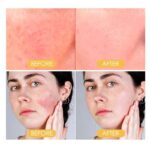 لاصقات الكاشفة لفعالية الصن بلوك -   Uv Protective Sticker